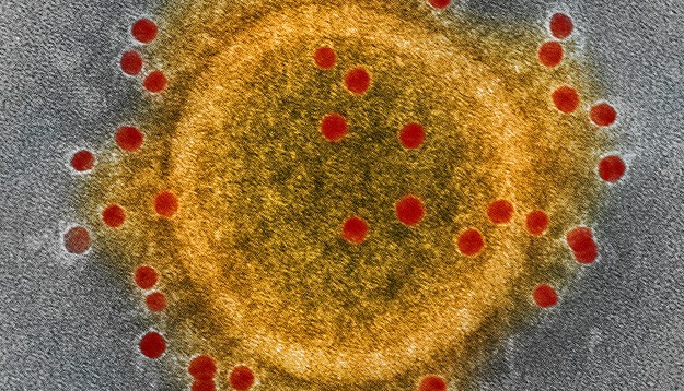 Главное о коронавирусе: как понять, что ты болен? Поможет ли маска? Где сдать тест?