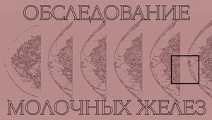 История о потерянном времени. Почему маммография иногда пропускает рак груди и что с этим делать