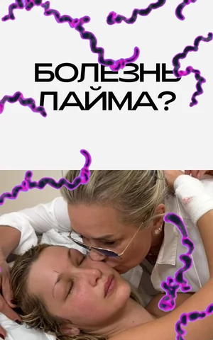 Хронический миф. Что такое болезнь Лайма на самом деле? И при чем тут Белла Хадид 