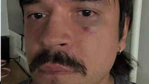 На основателя и дизайнера Atelier Odor Никиту Калмыкова напали