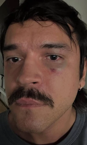 На основателя и дизайнера Atelier Odor Никиту Калмыкова напали