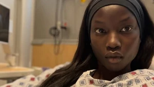 Анок Яй рассказала о перенесенной операции на легких