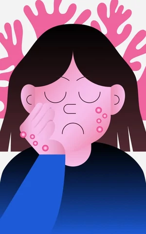 Мелочь, а неприятно. Что за зверь такой — контагиозный моллюск, и где им можно заразиться 