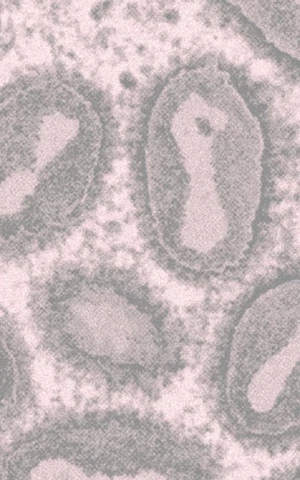 В Подмосковье выявили случай заражения оспой обезьян. Что известно о новой вспышке