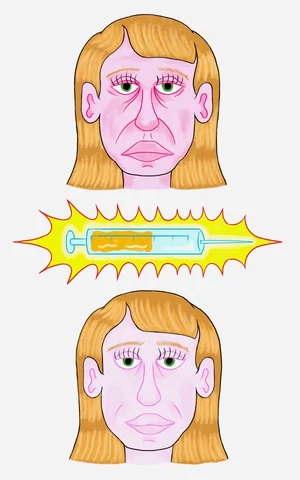 Новые модные уколы красоты — на основе жира, полученного из трупов. Что это за инъекции и кому они нужны?