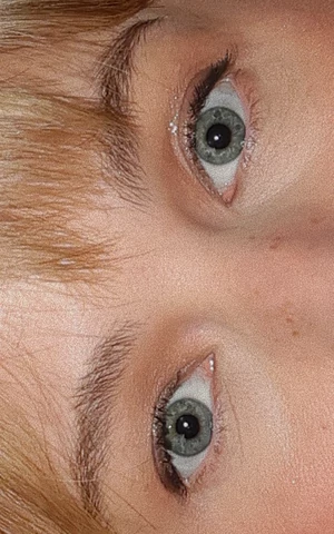 Поднимите мне веки. Как блефаропластика стала одной из самых обсуждаемых пластических операций